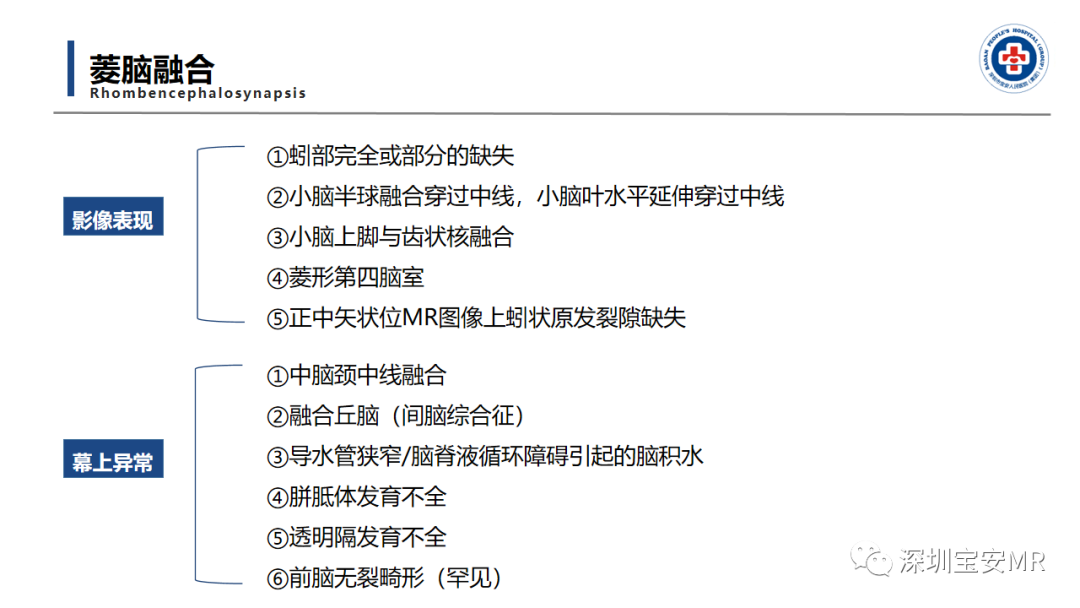 【PPT】后颅窝畸形-19