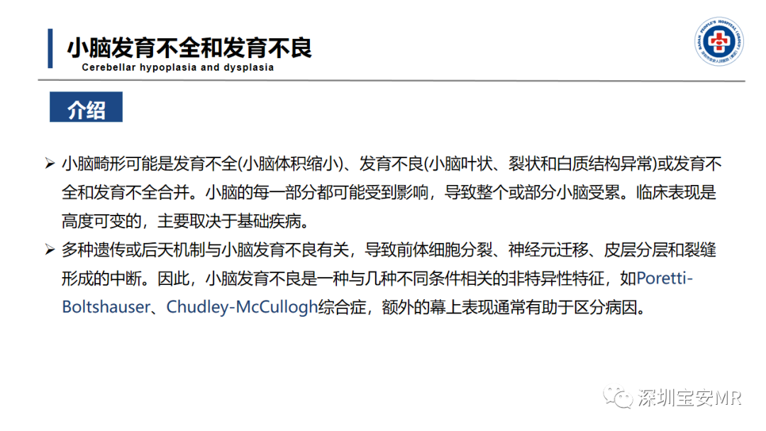 【PPT】后颅窝畸形-21