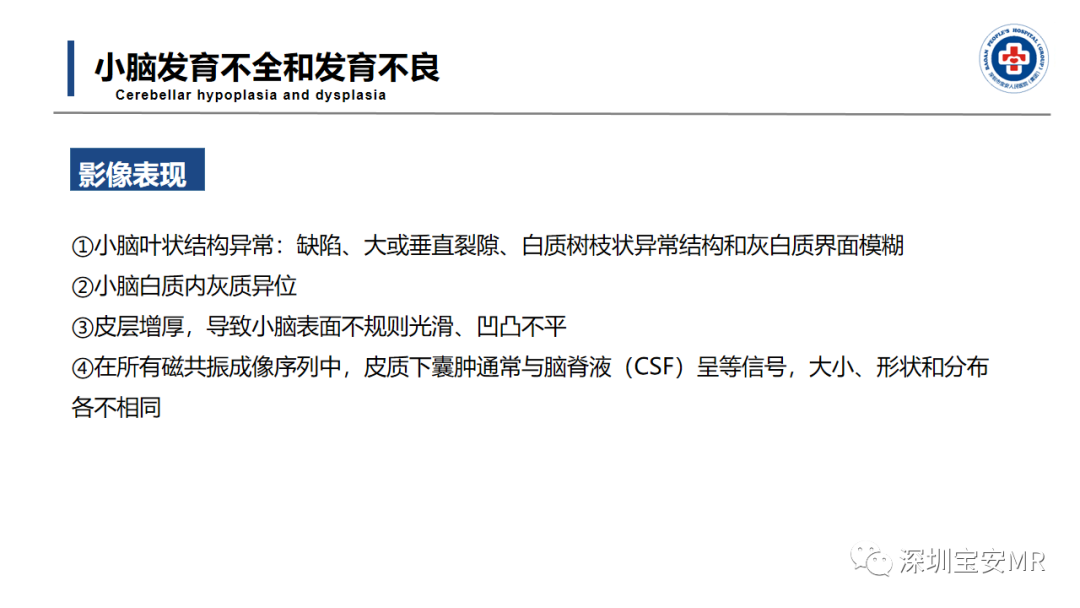 【PPT】后颅窝畸形-22