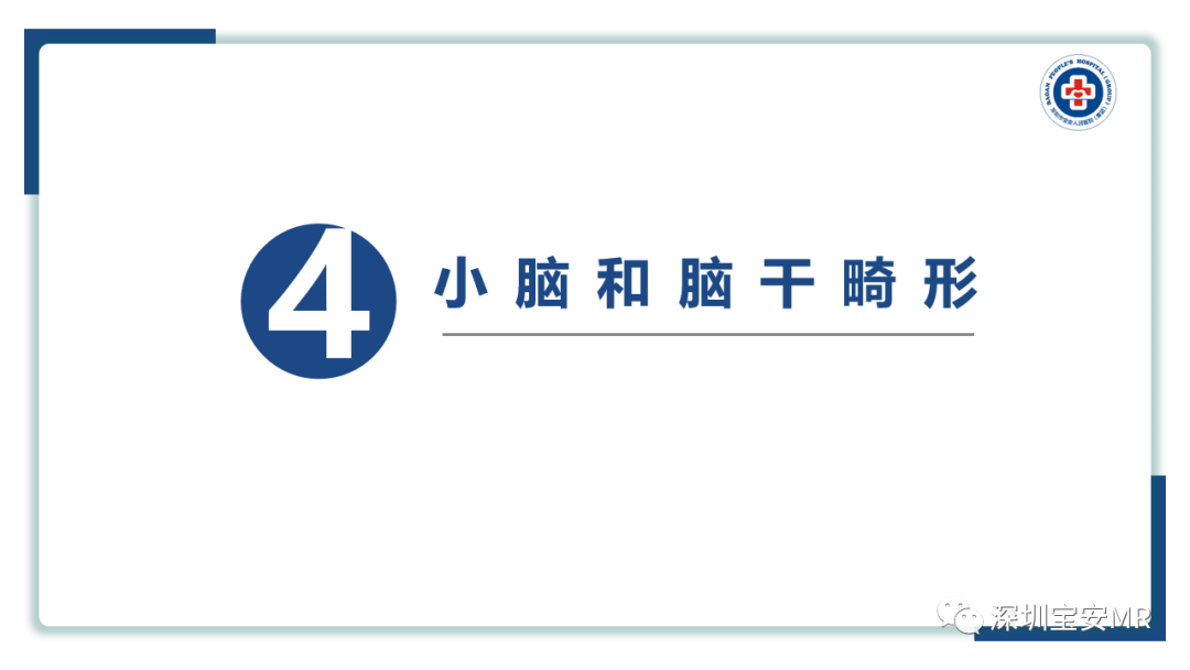 【PPT】后颅窝畸形-26