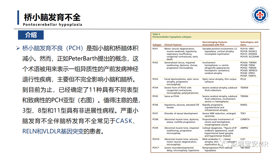 【PPT】后颅窝畸形-28