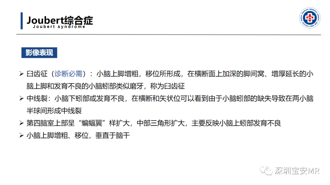 【PPT】后颅窝畸形-34