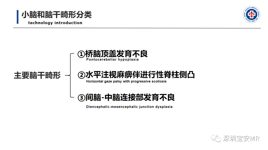 【PPT】后颅窝畸形-37