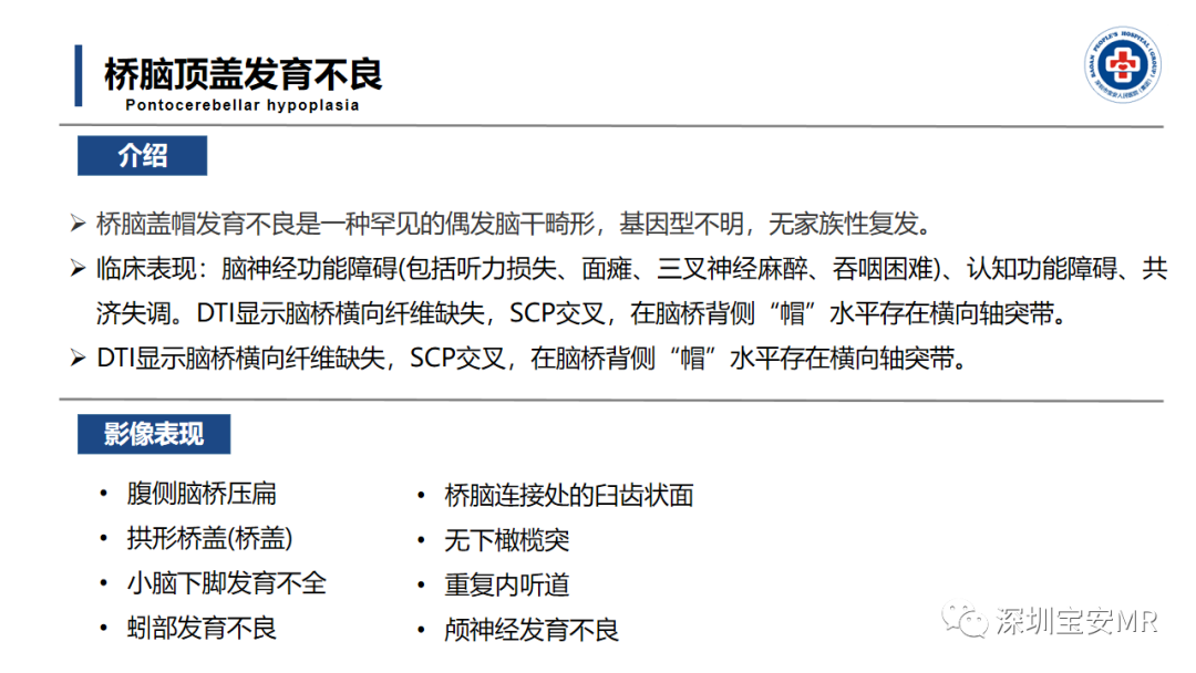 【PPT】后颅窝畸形-38