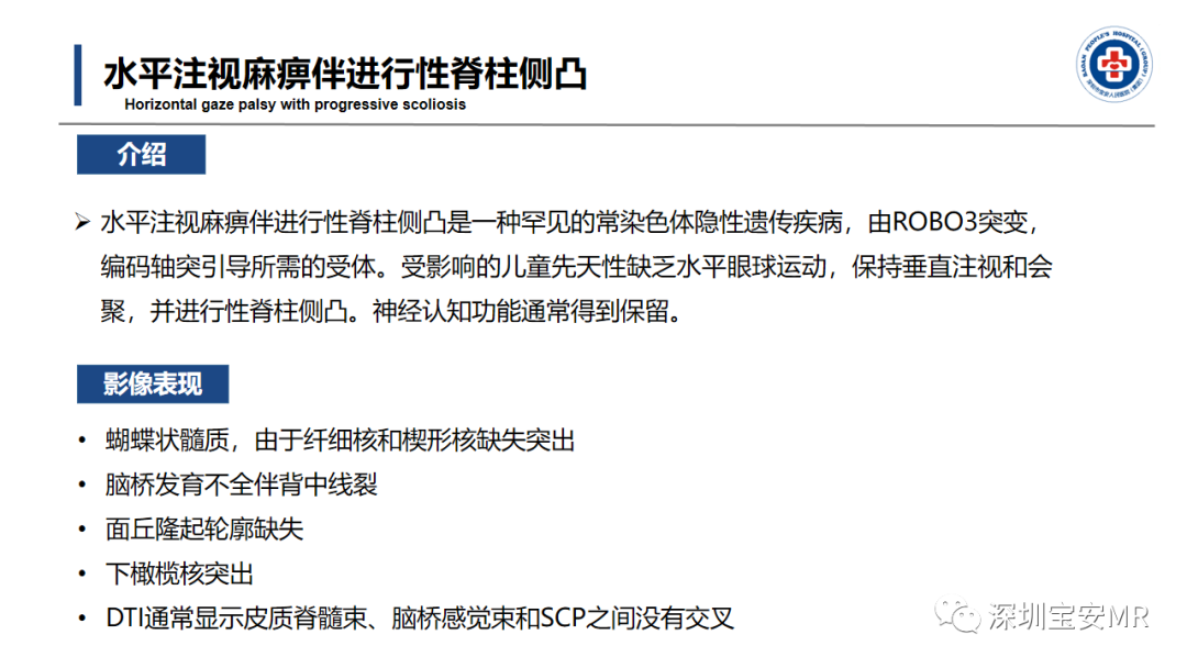 【PPT】后颅窝畸形-40