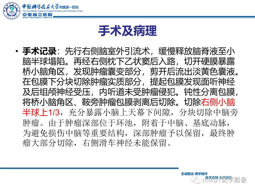 【PPT】毛细胞型星形细胞瘤病例解析-17