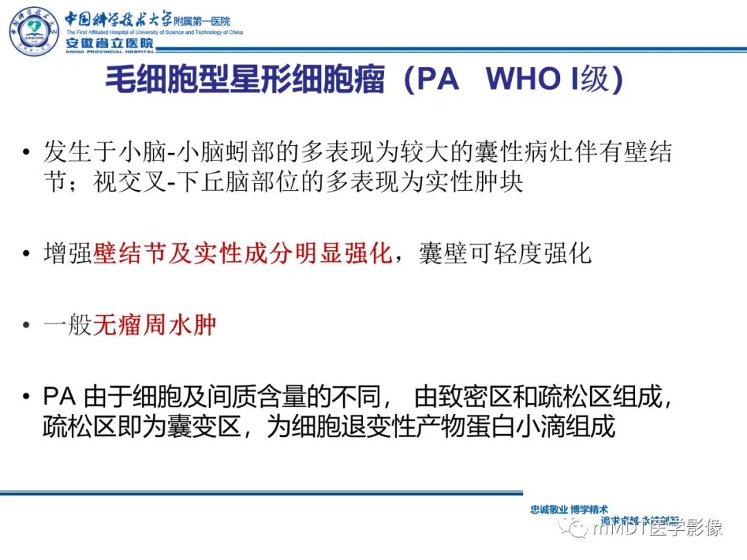 【PPT】毛细胞型星形细胞瘤病例解析-20