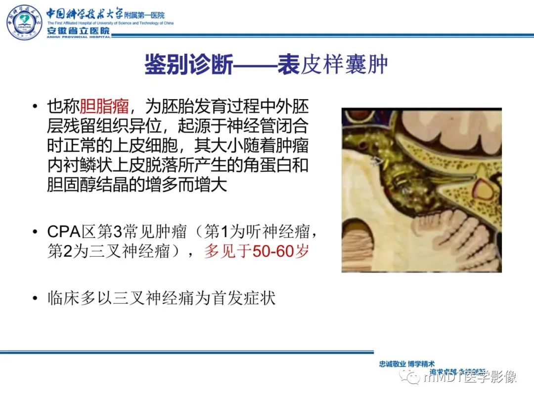 【PPT】毛细胞型星形细胞瘤病例解析-23