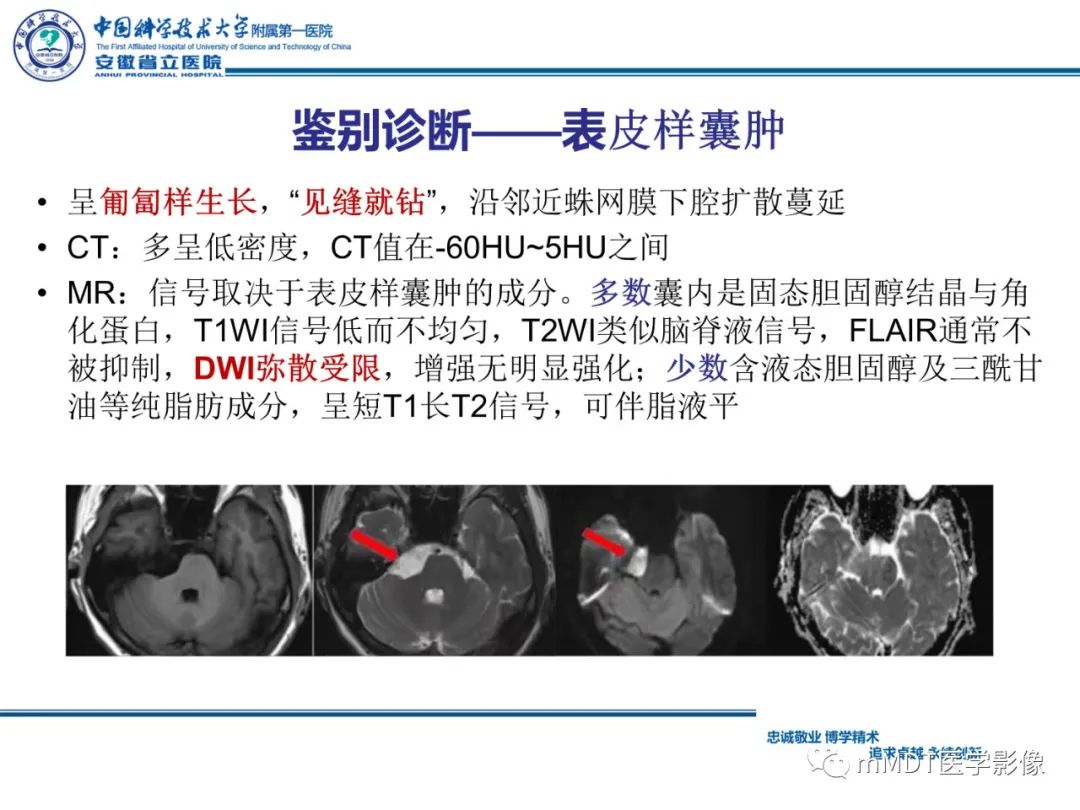 【PPT】毛细胞型星形细胞瘤病例解析-24