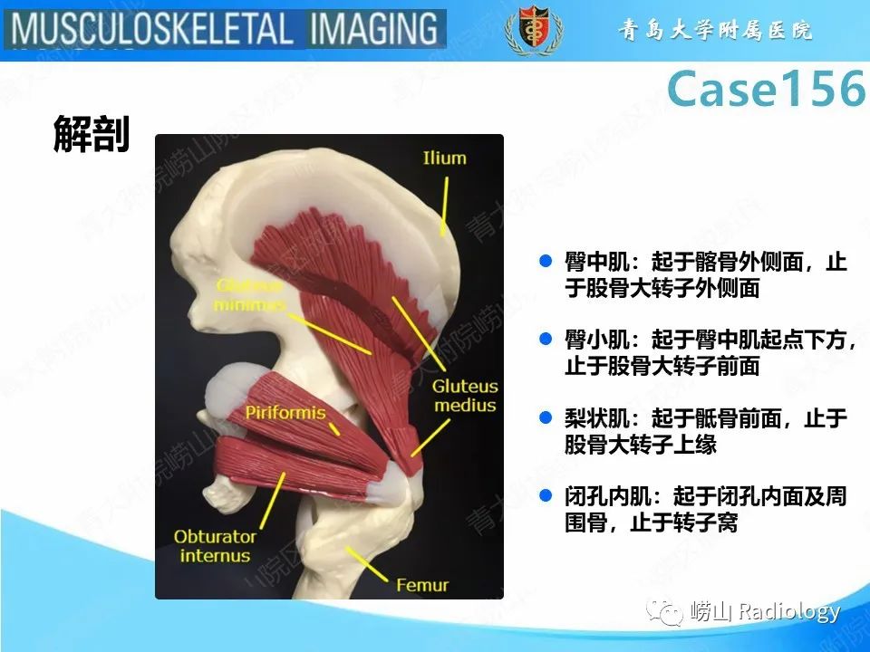 【PPT】臀中肌及臀小肌肌腱撕裂-17