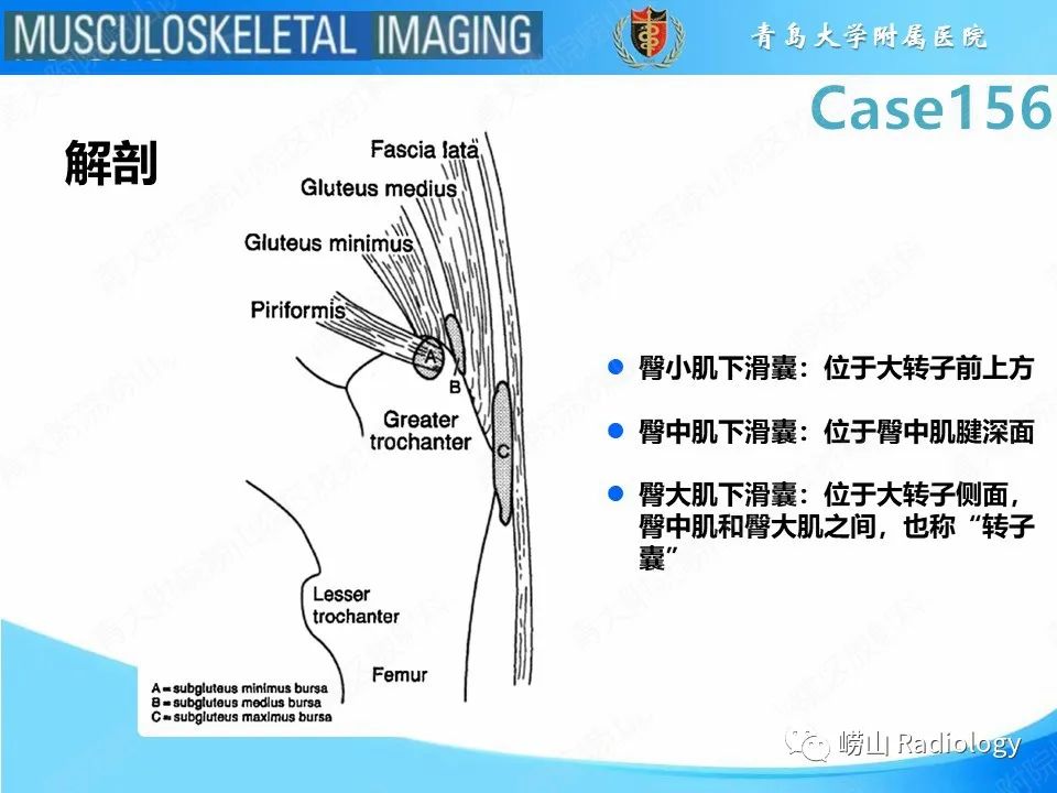 【PPT】臀中肌及臀小肌肌腱撕裂-18