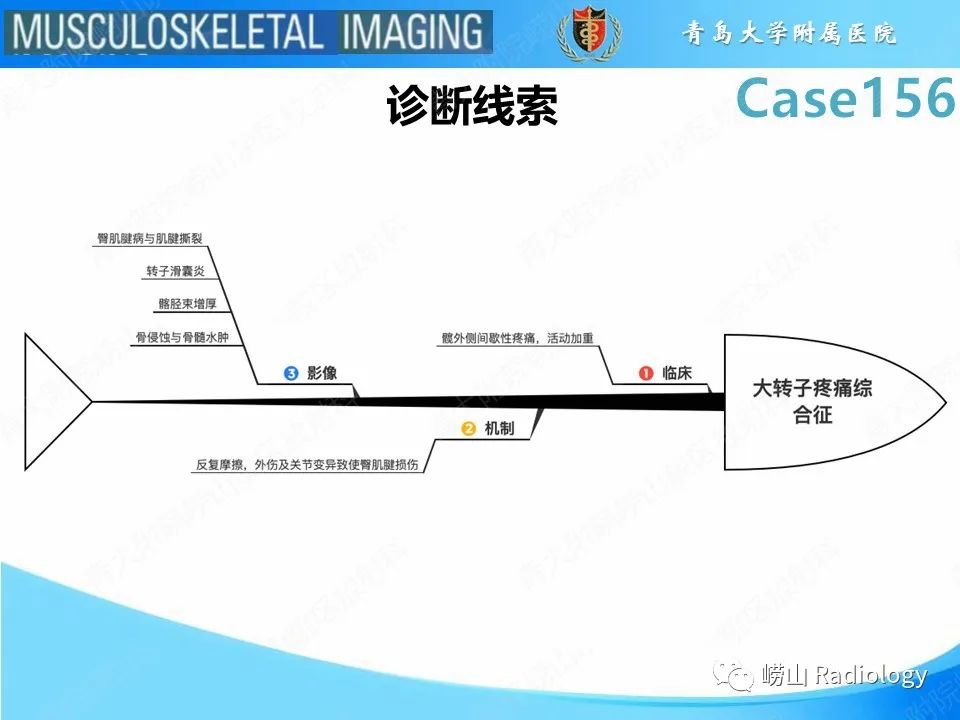 【PPT】臀中肌及臀小肌肌腱撕裂-29