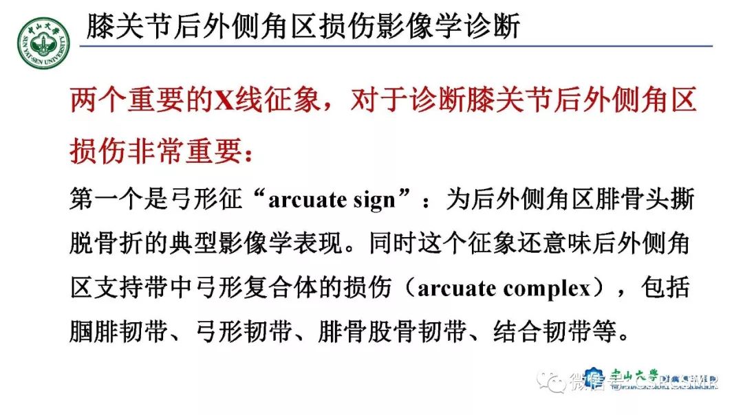 【PPT】膝关节后外侧角区影像解剖及损伤后影像学诊断-36