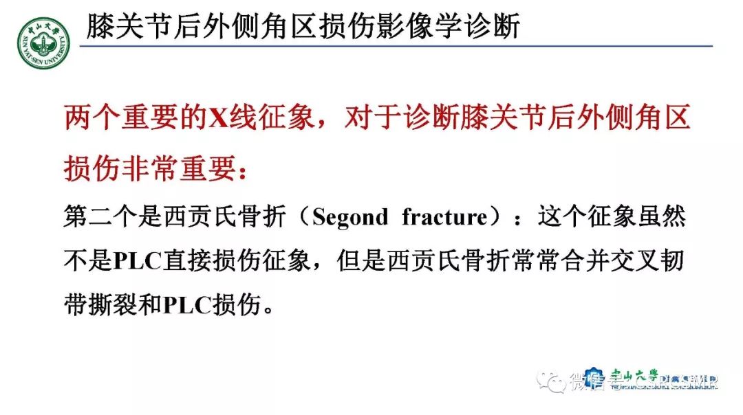 【PPT】膝关节后外侧角区影像解剖及损伤后影像学诊断-37
