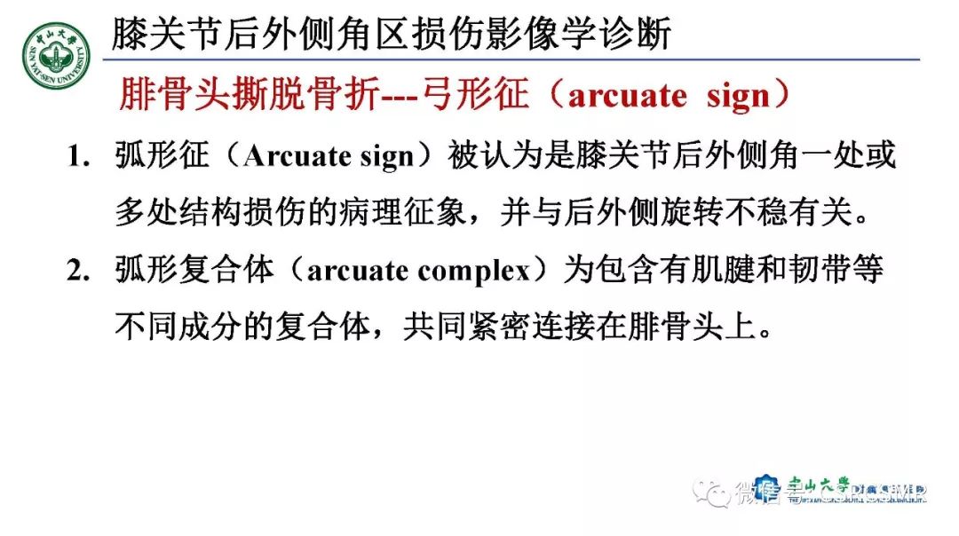【PPT】膝关节后外侧角区影像解剖及损伤后影像学诊断-43