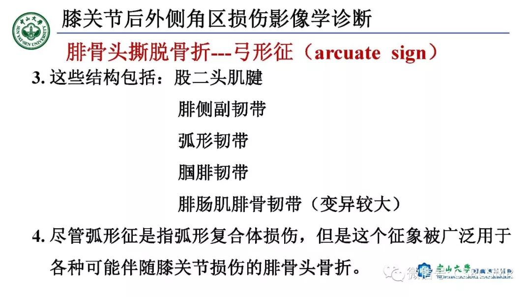【PPT】膝关节后外侧角区影像解剖及损伤后影像学诊断-44