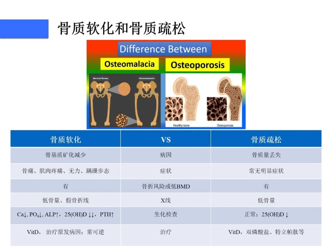 【病例】磷酸盐尿性间叶性肿瘤1例影像学诊断思路-13