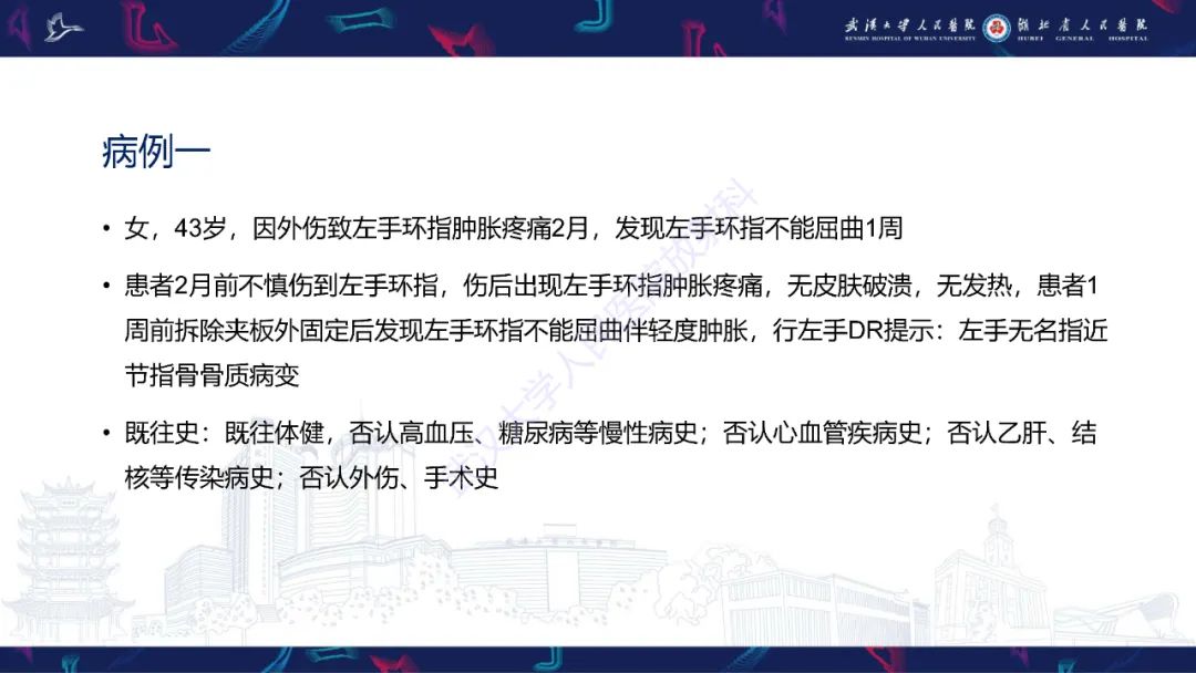 【PPT】指骨肿瘤影像诊断-2