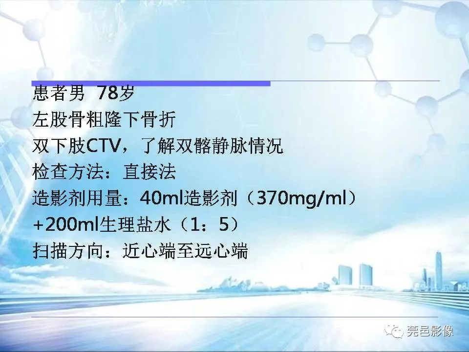 【PPT】浅谈下肢静脉CTV的应用体会-15