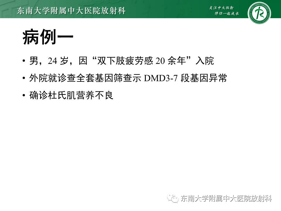 【PPT】心肌致密化不全-1