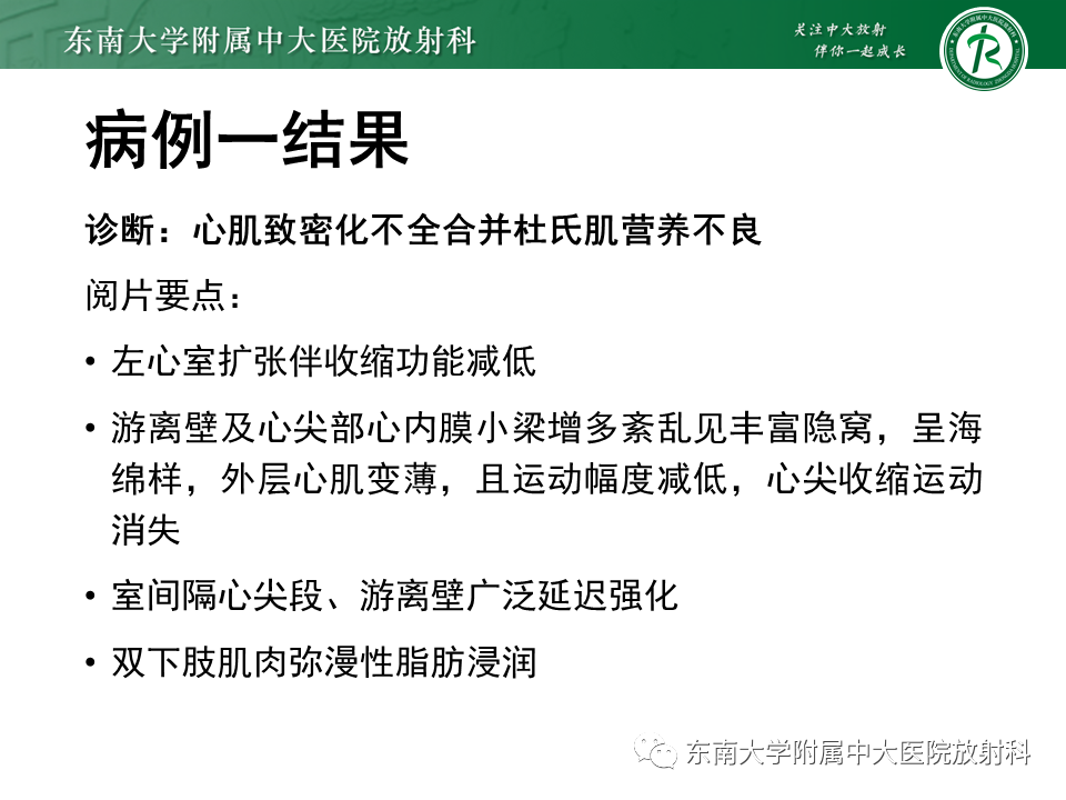 【PPT】心肌致密化不全-9