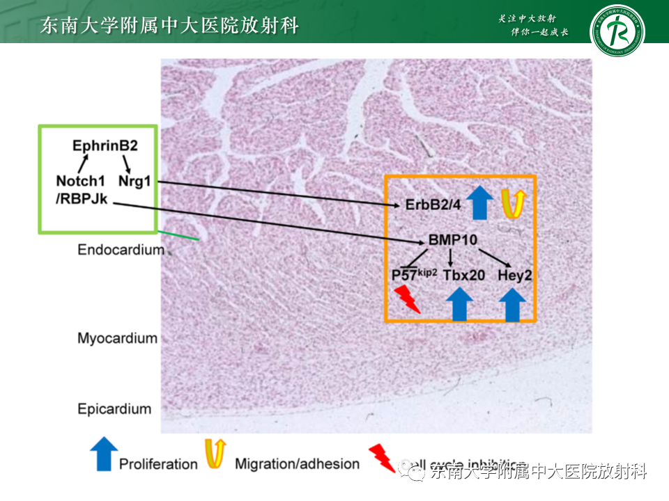 【PPT】心肌致密化不全-38