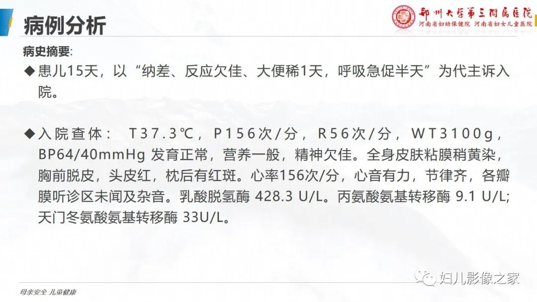 【PPT】肺泡蛋白沉积症的影像诊断-2