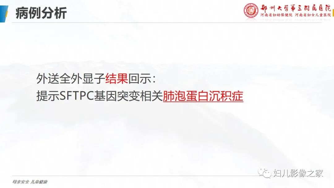 【PPT】肺泡蛋白沉积症的影像诊断-6