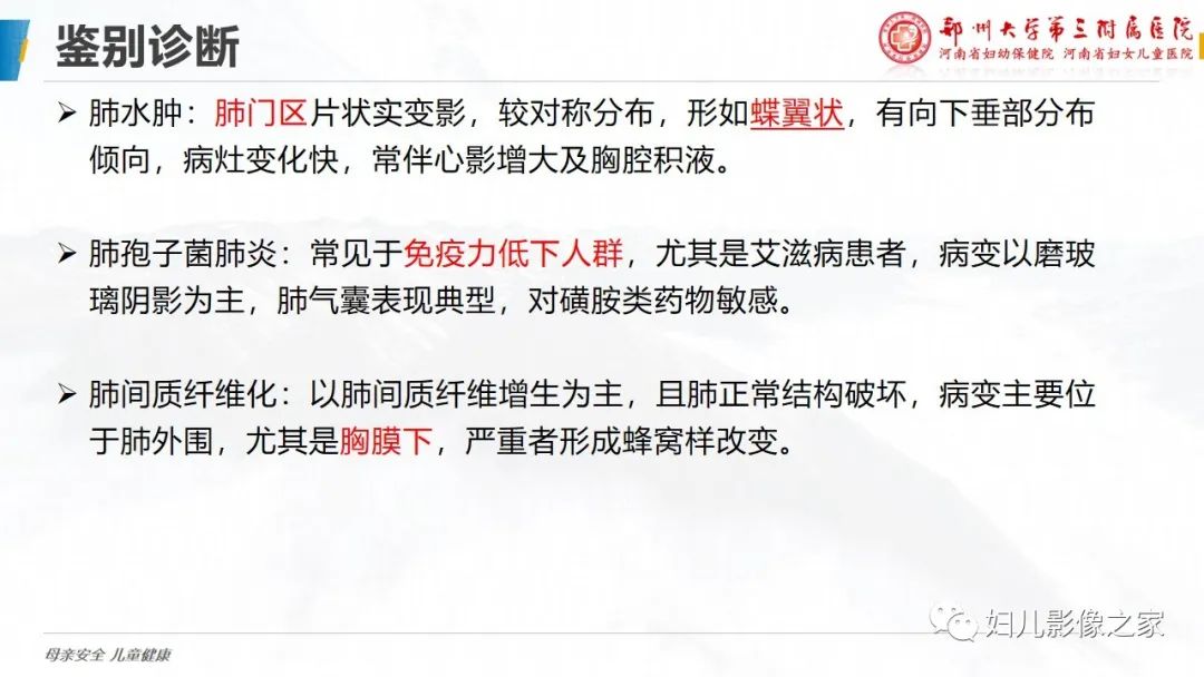 【PPT】肺泡蛋白沉积症的影像诊断-17