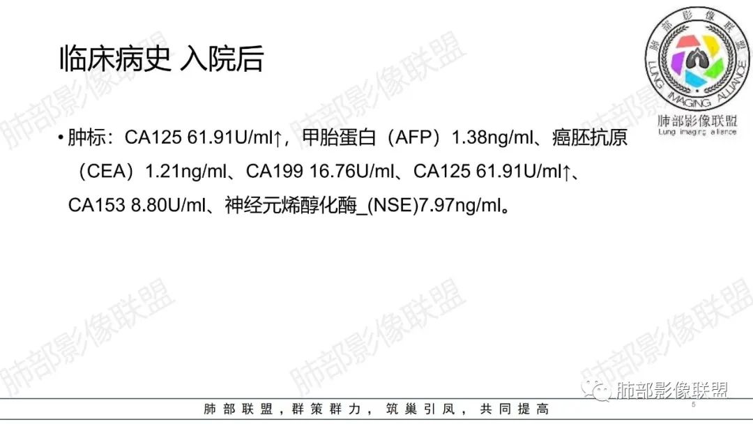 【病例】肺部弥漫大B淋巴瘤病例思考及启示-5