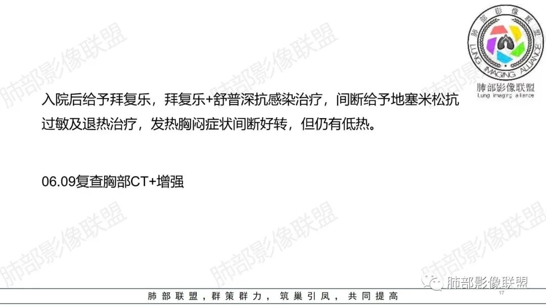 【病例】肺部弥漫大B淋巴瘤病例思考及启示-17