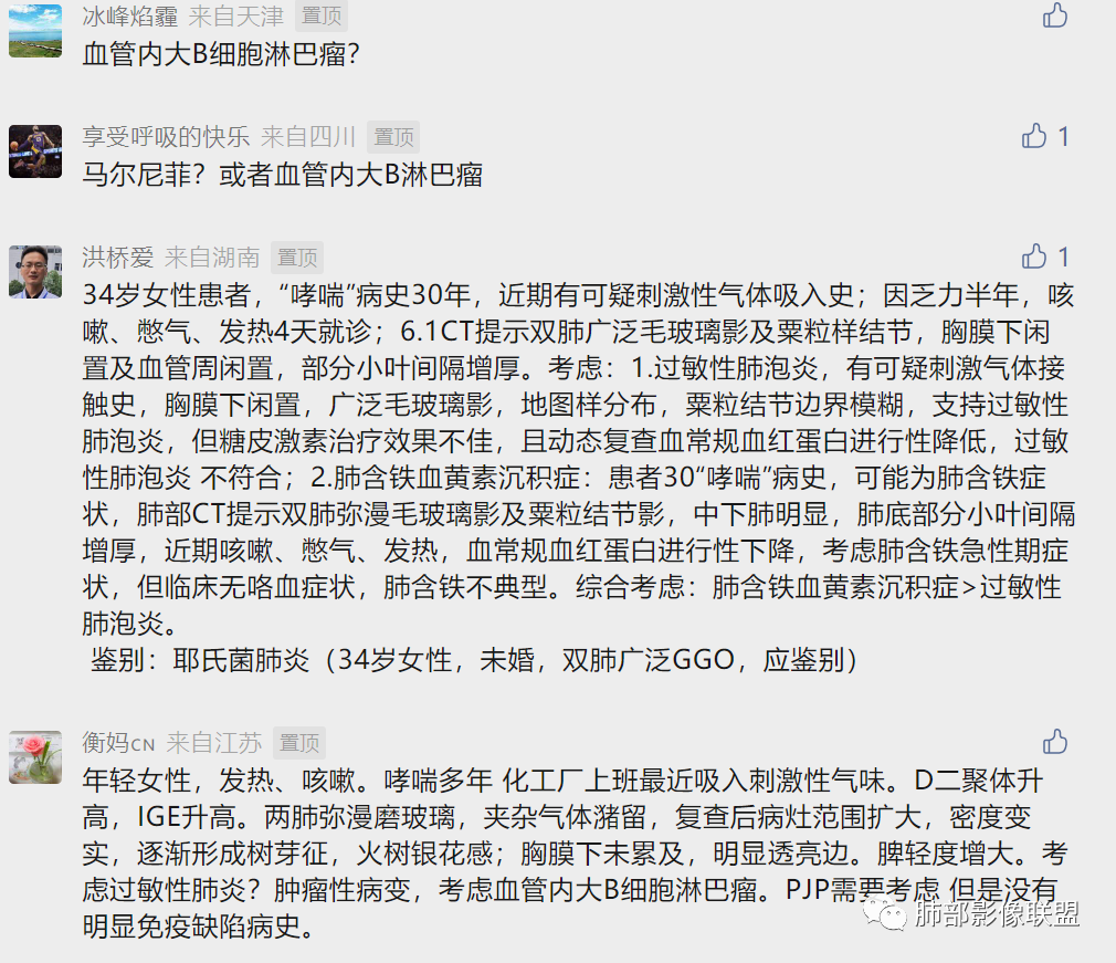【病例】肺部弥漫大B淋巴瘤病例思考及启示-51