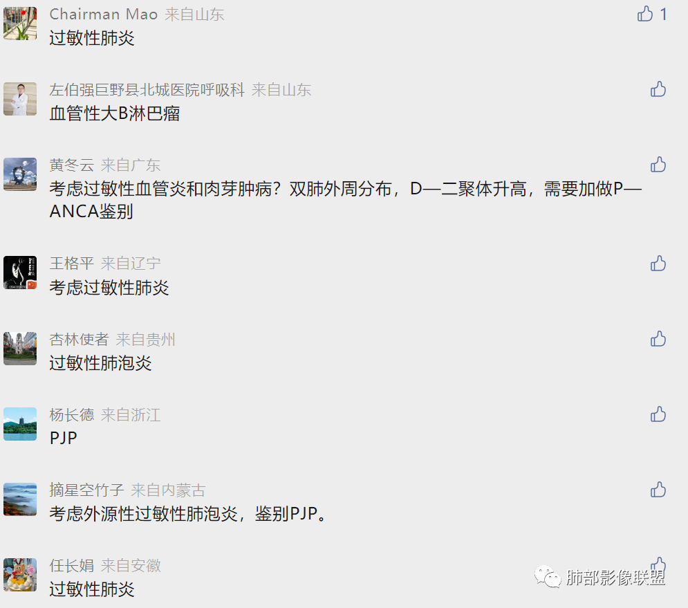 【病例】肺部弥漫大B淋巴瘤病例思考及启示-52