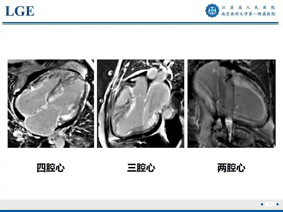 【PPT】心肌淀粉样变-8