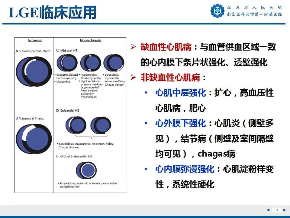 【PPT】心肌淀粉样变-19