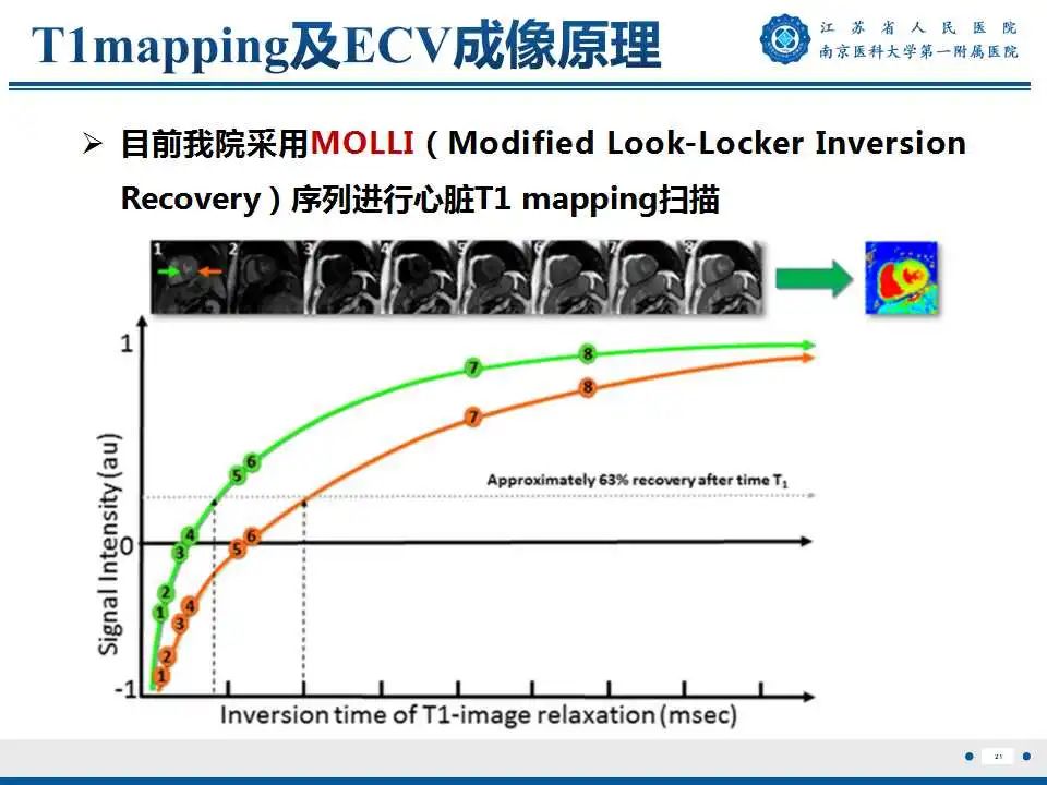 【PPT】心肌淀粉样变-22