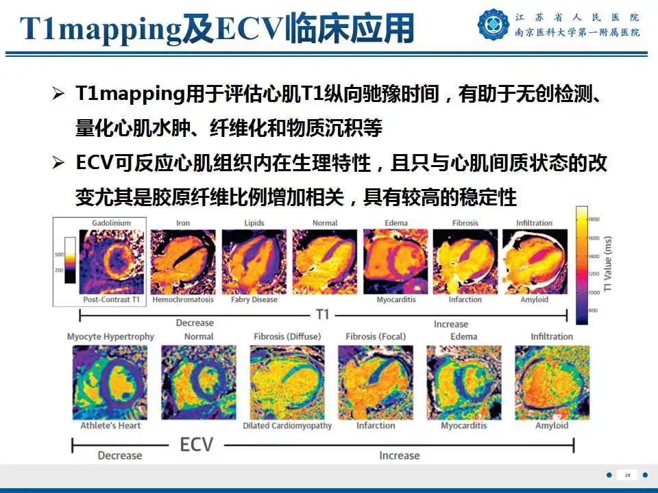 【PPT】心肌淀粉样变-27