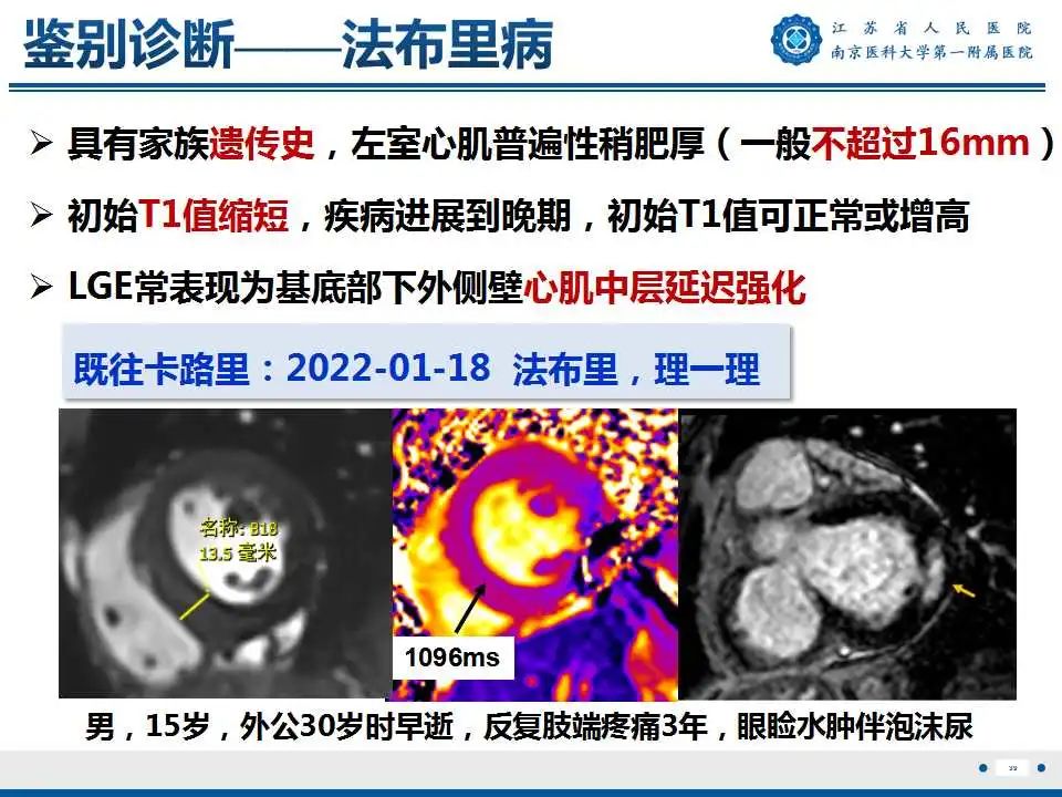 【PPT】心肌淀粉样变-40