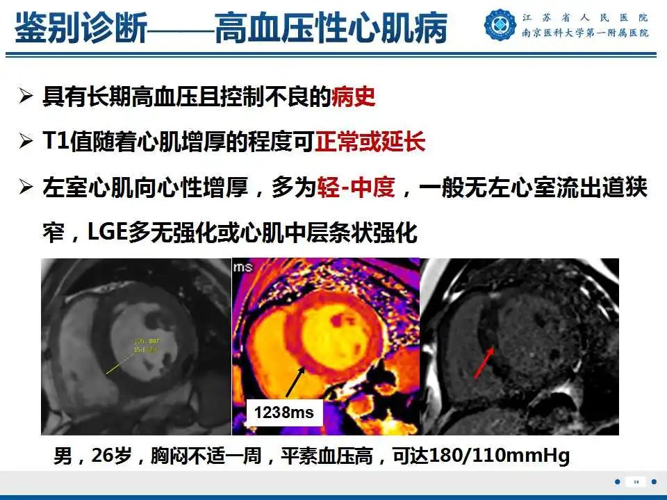 【PPT】心肌淀粉样变-39