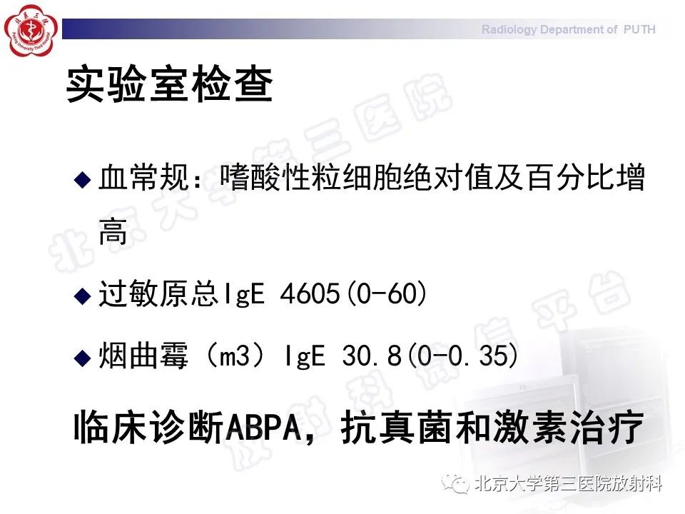 【PPT】变态反应性支气管肺曲霉菌病-10