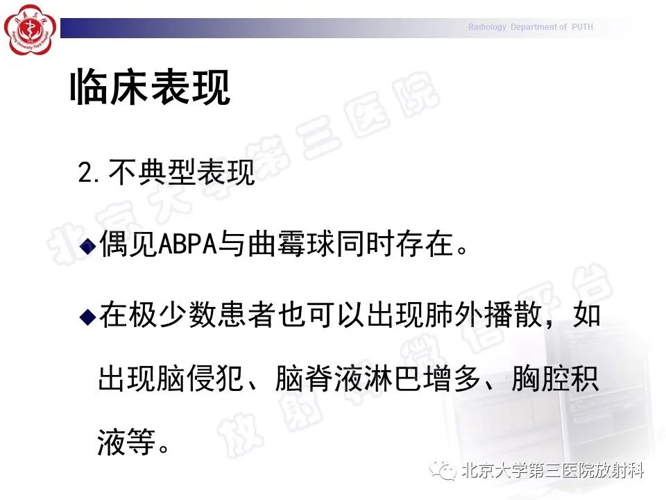 【PPT】变态反应性支气管肺曲霉菌病-19