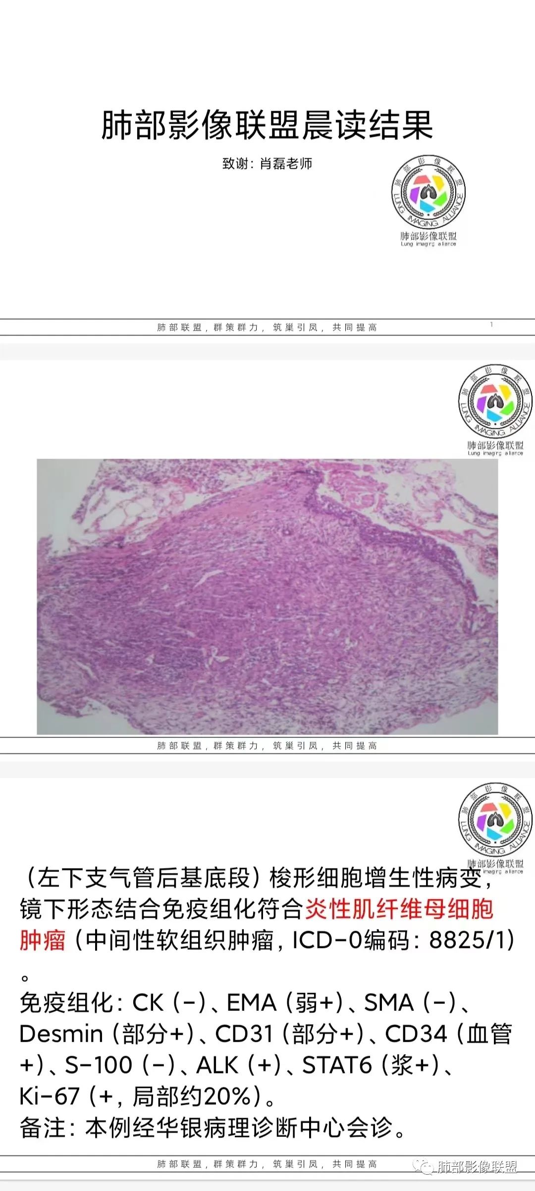 【病例】支气管腔内结节灶，你能想到哪些病变？-28