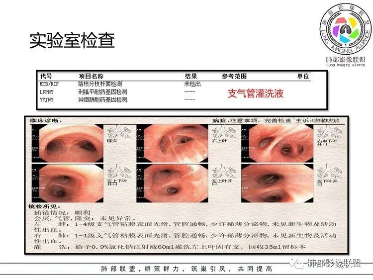 【病例】支原体肺炎-5