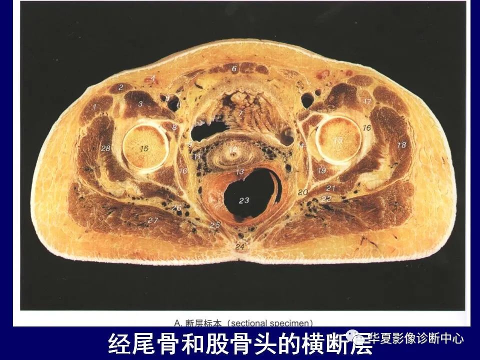 【PPT】下肢的断层解剖-17