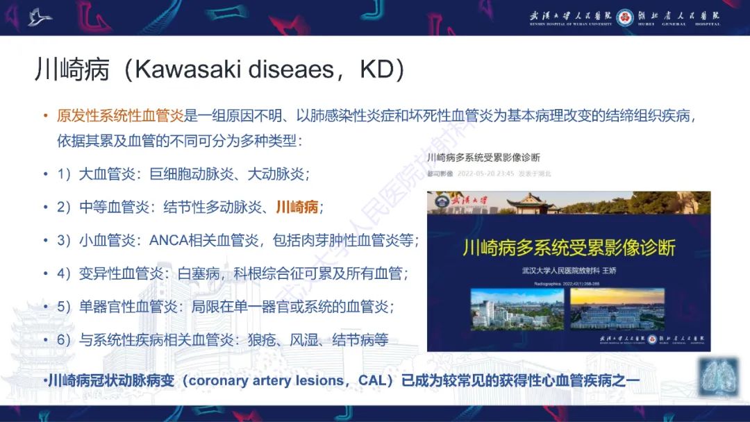 【PPT】川崎病冠状动脉病变影像诊断-6