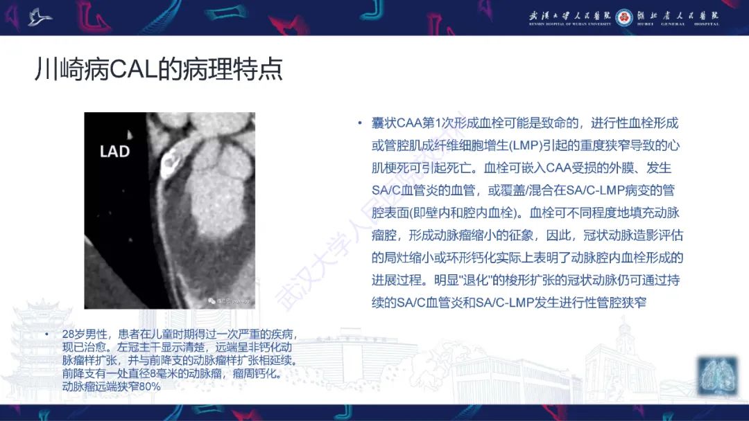 【PPT】川崎病冠状动脉病变影像诊断-8