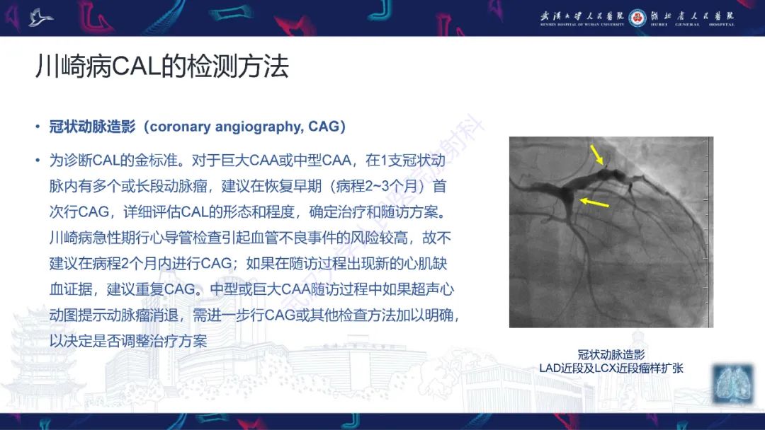 【PPT】川崎病冠状动脉病变影像诊断-15