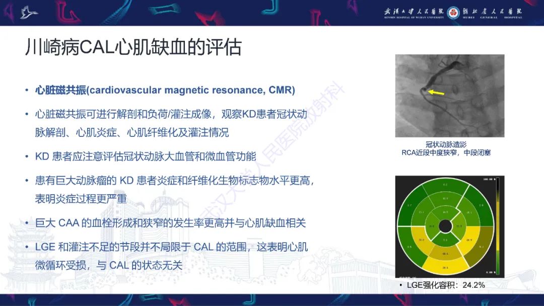 【PPT】川崎病冠状动脉病变影像诊断-21