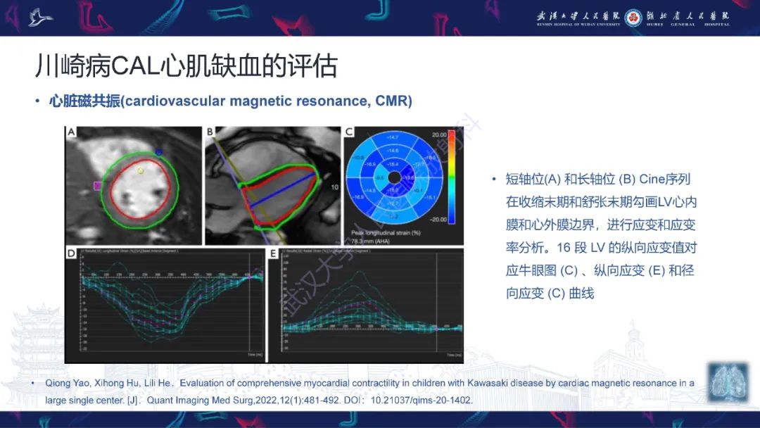 【PPT】川崎病冠状动脉病变影像诊断-23