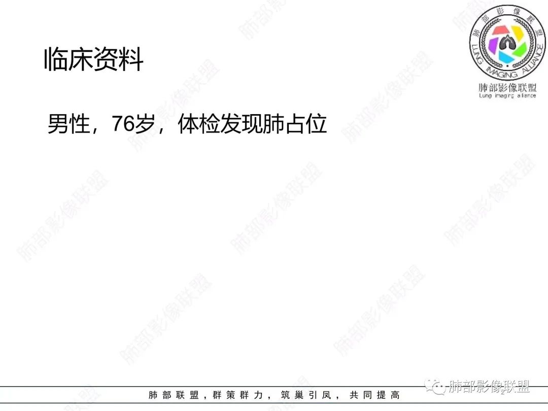 【病例】胸膜下的混合密度结节—良恶之争-2